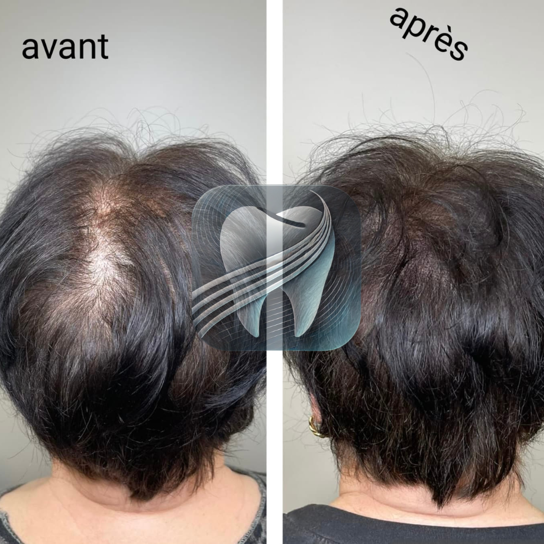 Avant / Après 2